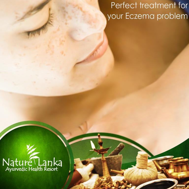 Nature Lanka Ayurveda Resort - All Meals And Ayurveda Treatments With Yoga Tangalle Exteriér fotografie